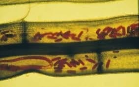 Endoparasitic-Nematode