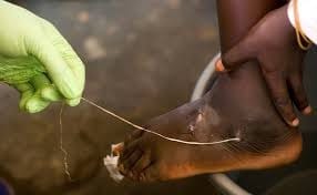 Guinea-Worm