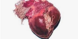 Heartworm