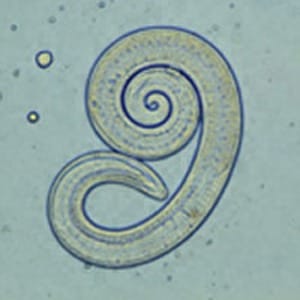 Trichina-Worm